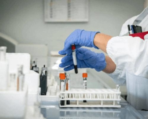 Alzheimer, allo studio nuovo test del sangue per diagnosi precoce