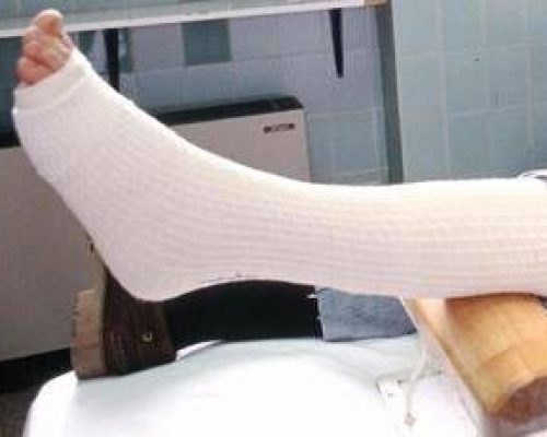 Toccare una frattura nella realtà aumentata, da UniPi sensore tattile low cost